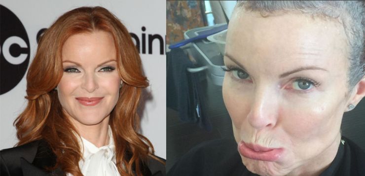 marcia-cross-cancro-Bree-Van-De-Kamp-desperate-housewives