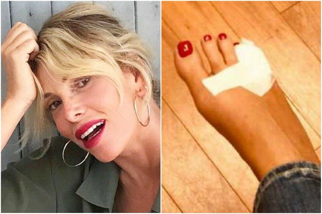 alessia-marcuzzi-le-iene-incidente-piedi-feet.jpeg