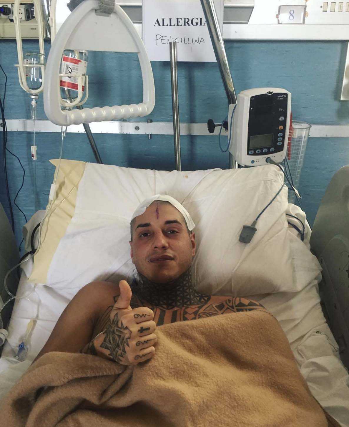 francesco-chiofalo-tumore-cervello-operazione-selvaggia-roma