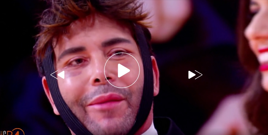 giacomo-urtis-cr4-chiambretti-lifting-chirurgia