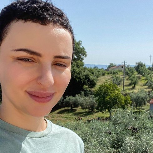 Arisa ammette il ritocchino estetico al viso: ecco cosa ha rifatto
