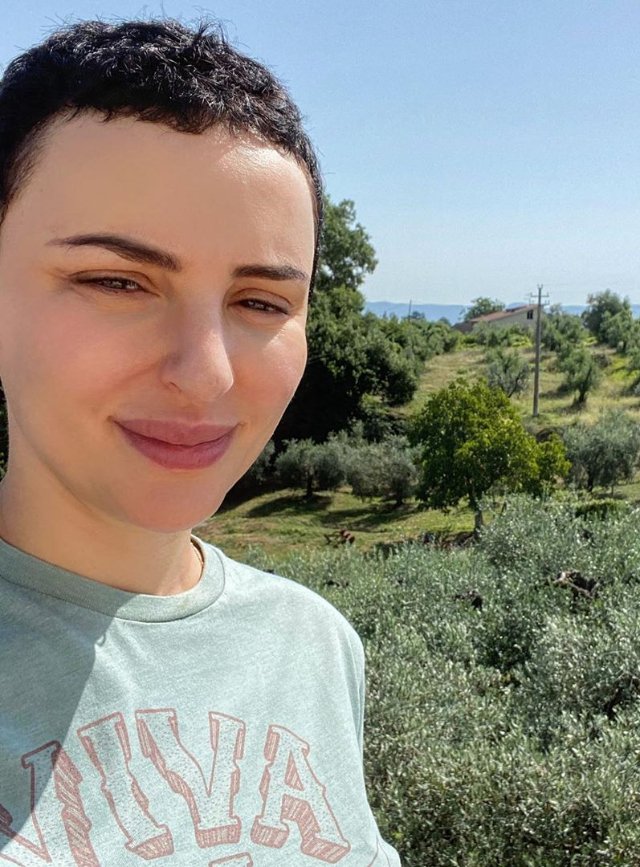 La cantante è pentita del ritocchino alle labbra