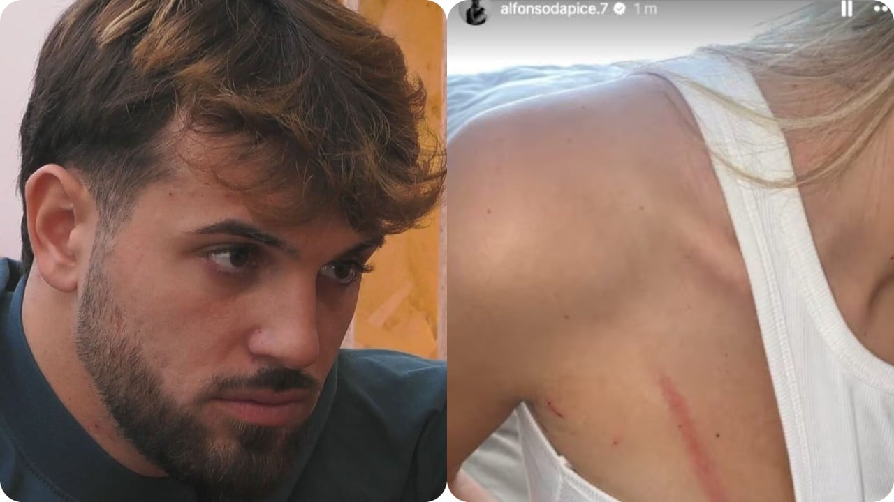 alfonso e chiara aggrediti