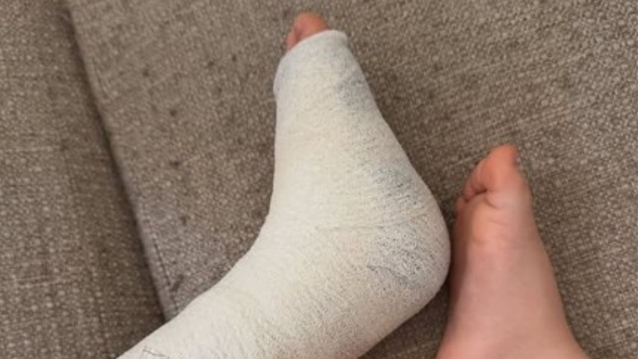 figlio francesca ferragni piede ingessato