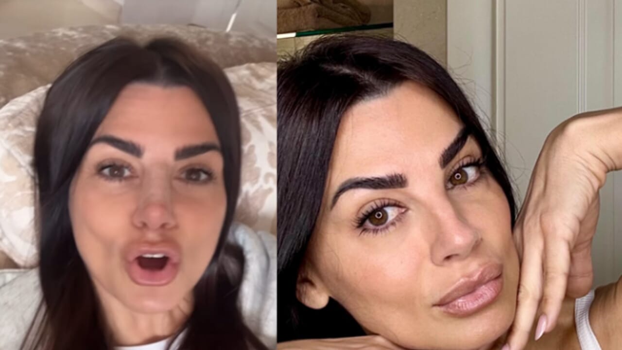 Serena Enardu naso rifatto