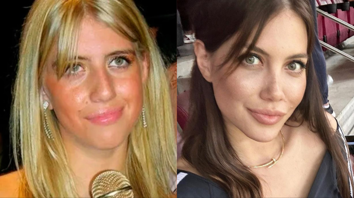 wanda nara prima e dopo