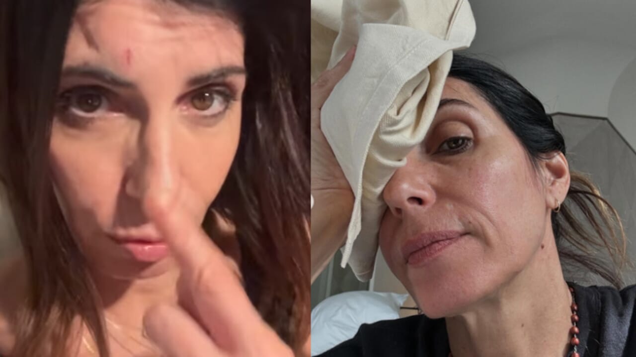 Giorgia ferita volto