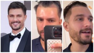 Andrea Zelletta trapianto