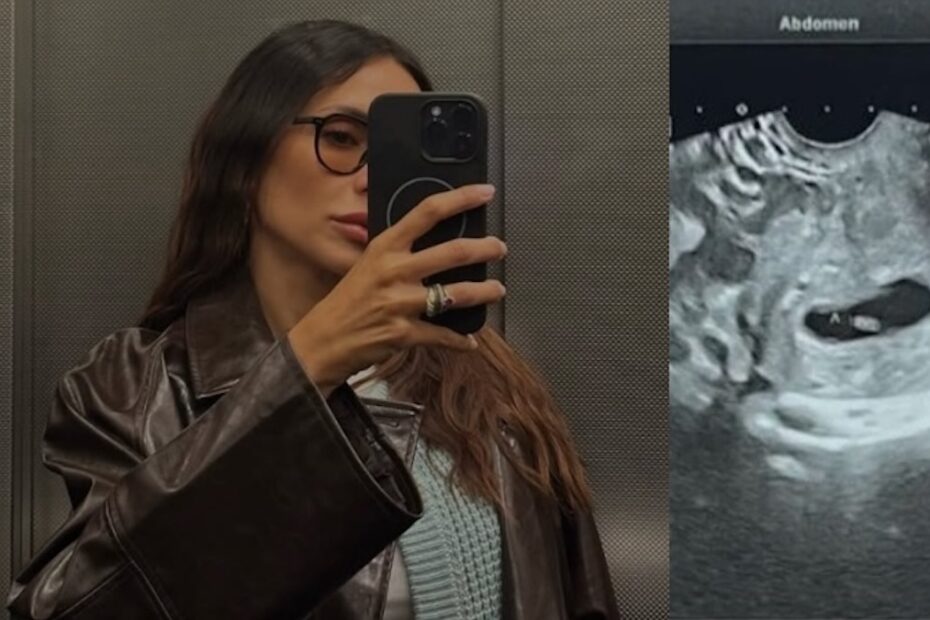 volto canale 5 bimbo